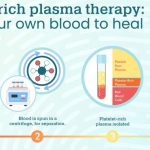 Understanding the Advantages of PRP Therapy