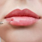 Juvederm vs Botox for Lips: Which Treatment Is Better?