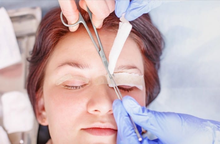 How to Find the Best Blepharoplasty Surgeon in Your City